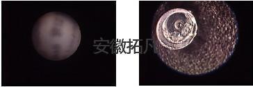 關(guān)節(jié)鏡.jpg