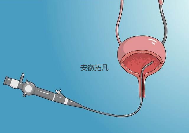 輸尿管鏡維修